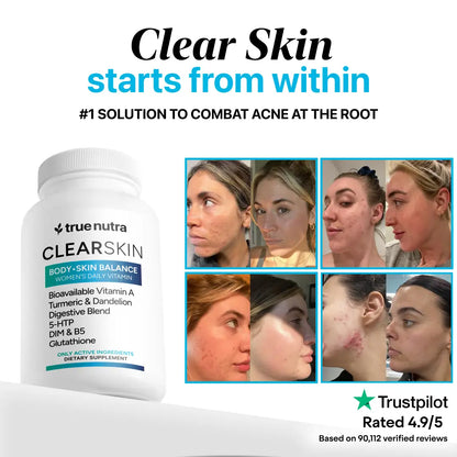CLEARSKIN™